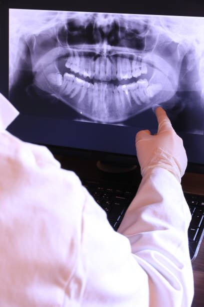 Best Emergency Root Canal Therapy in Tangelo Park, FL