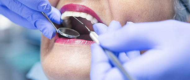 Best Broken or Chipped Tooth Repair in Tangelo Park, FL